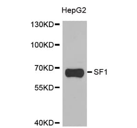 Western blot - SF1 antibody from Signalway Antibody (38902) - Antibodies.com