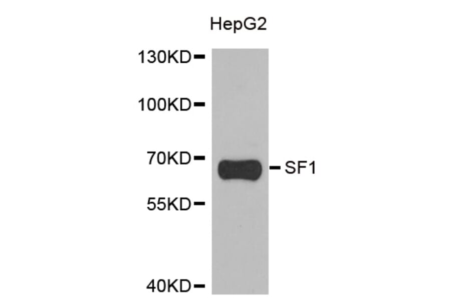 Western blot - SF1 antibody from Signalway Antibody (38902) - Antibodies.com