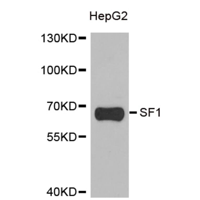 Western blot - SF1 antibody from Signalway Antibody (38902) - Antibodies.com