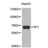 Western blot - SF1 antibody from Signalway Antibody (38902) - Antibodies.com