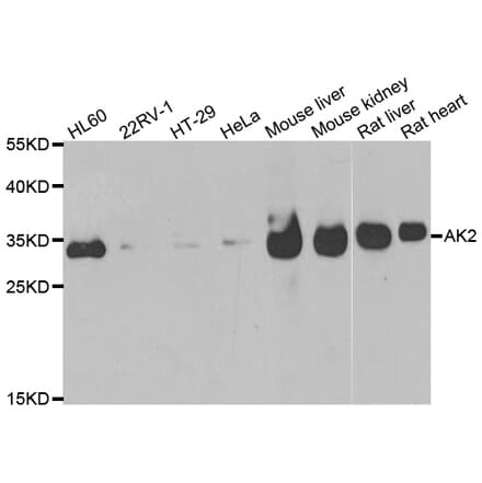 Western blot - AK2 antibody from Signalway Antibody (38973) - Antibodies.com