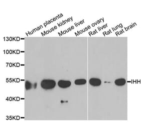 Western blot - IHH antibody from Signalway Antibody (39054) - Antibodies.com