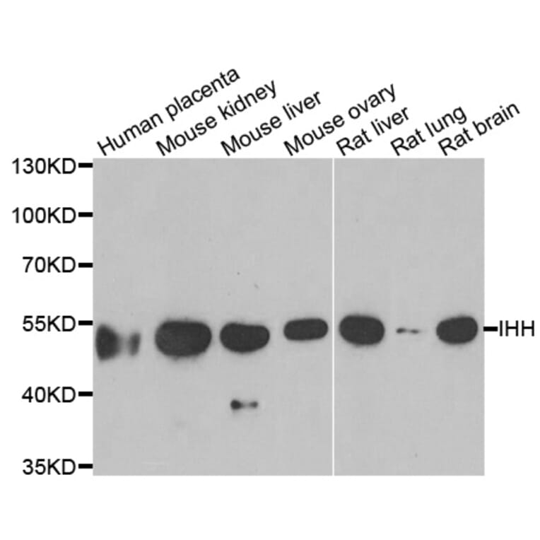 Western blot - IHH antibody from Signalway Antibody (39054) - Antibodies.com