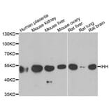 Western blot - IHH antibody from Signalway Antibody (39054) - Antibodies.com