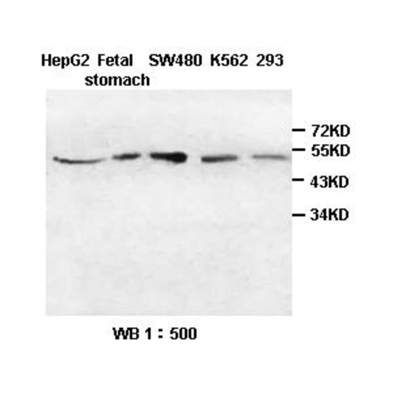 HIP Antibody from Signalway Antibody (39392) - Antibodies.com