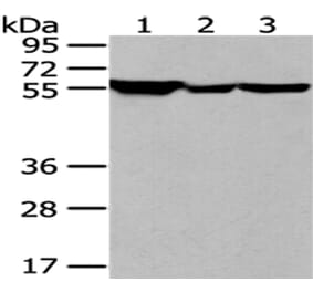 FYN Antibody from Signalway Antibody (43186) - Antibodies.com
