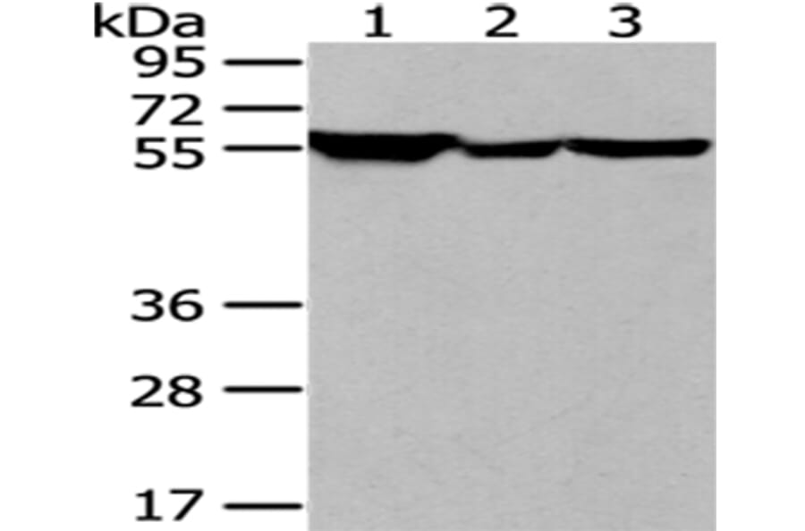 FYN Antibody from Signalway Antibody (43186) - Antibodies.com
