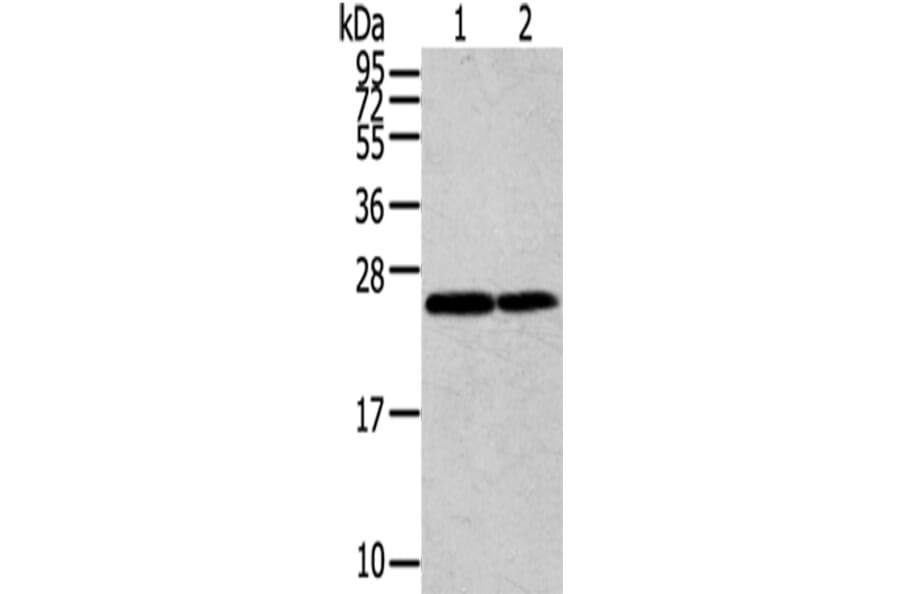 RAN Antibody from Signalway Antibody (43323) - Antibodies.com