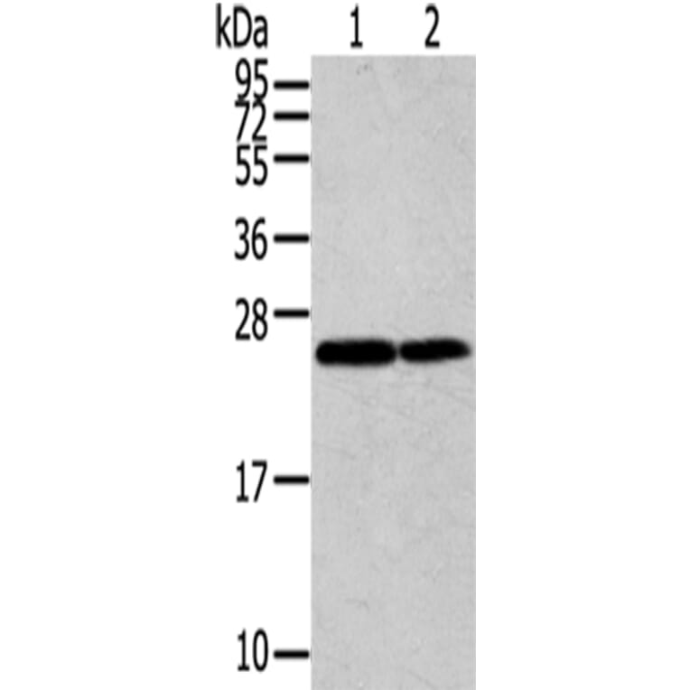RAN Antibody from Signalway Antibody (43323) - Antibodies.com