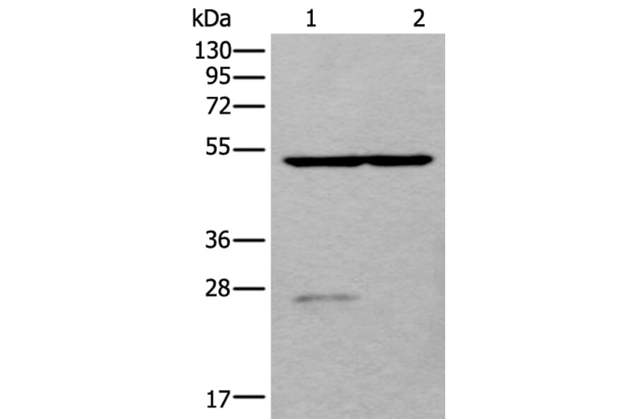 DDC Antibody from Signalway Antibody (43658) - Antibodies.com