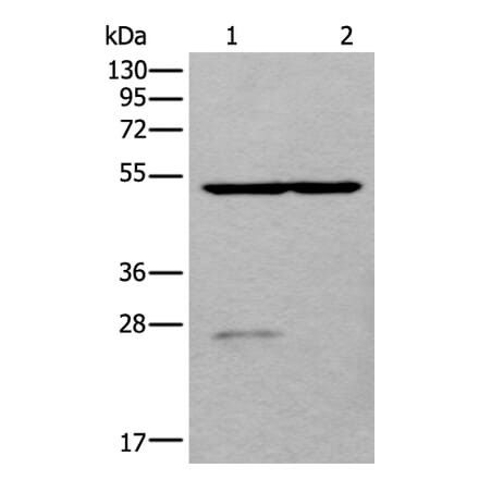 DDC Antibody from Signalway Antibody (43658) - Antibodies.com