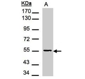 Aspartyl aminopeptidase antibody from Signalway Antibody (22266) - Antibodies.com