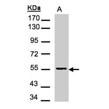 Aspartyl aminopeptidase antibody from Signalway Antibody (22266) - Antibodies.com