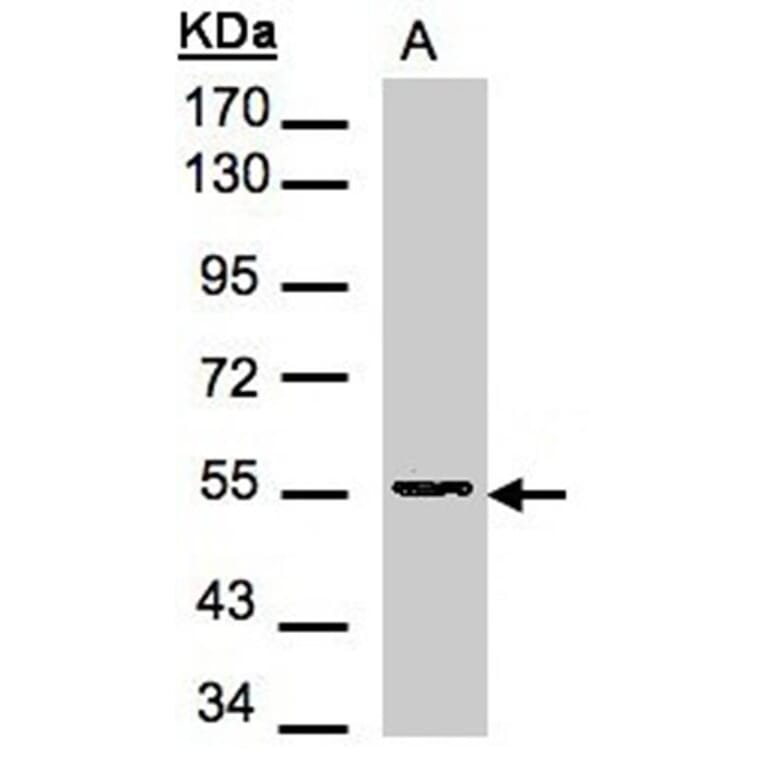 Aspartyl aminopeptidase antibody from Signalway Antibody (22266) - Antibodies.com