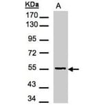 Aspartyl aminopeptidase antibody from Signalway Antibody (22266) - Antibodies.com