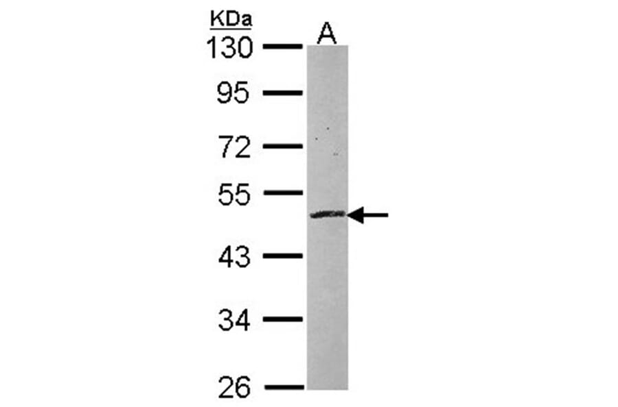 zinc finger protein 140 antibody from Signalway Antibody (23079) - Antibodies.com