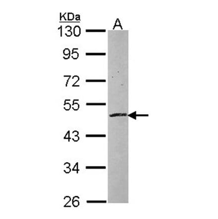 zinc finger protein 140 antibody from Signalway Antibody (23079) - Antibodies.com