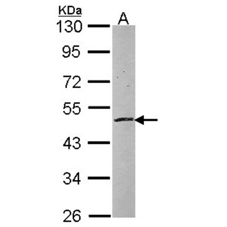 zinc finger protein 140 antibody from Signalway Antibody (23079) - Antibodies.com