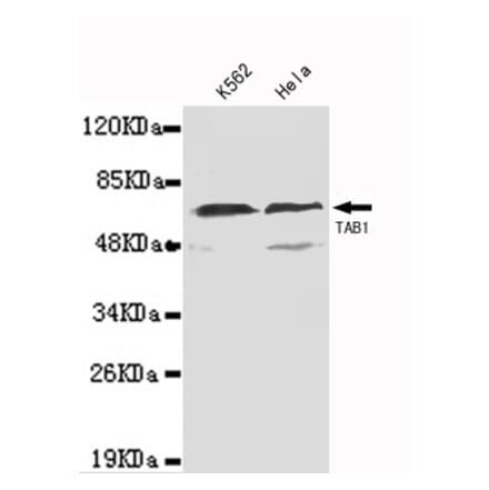 TAB1 (N-term) Monoclonal Antibody from Signalway Antibody (27075) - Antibodies.com