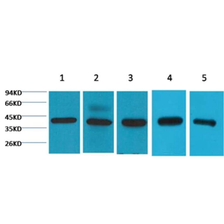 Western blot - eIF4A1 Mouse Monoclonal Antibody from Signalway Antibody (38072) - Antibodies.com