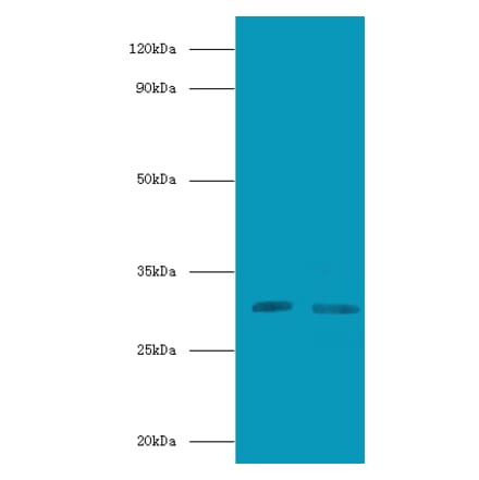 CD82 antigen Polyclonal Antibody from Signalway Antibody (42112) - Antibodies.com