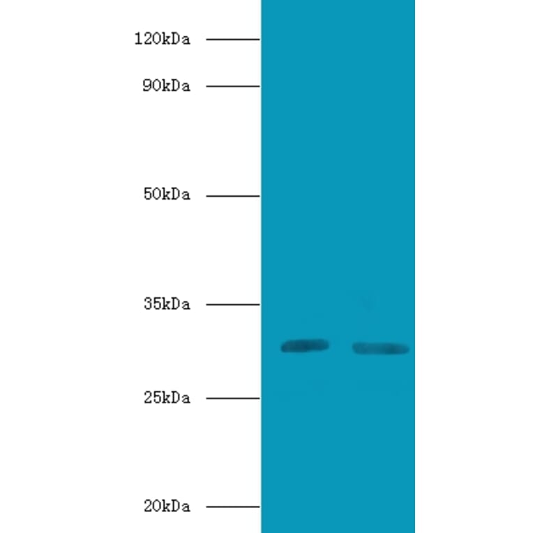 CD82 antigen Polyclonal Antibody from Signalway Antibody (42112) - Antibodies.com
