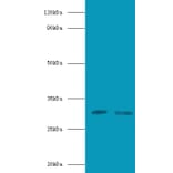 CD82 antigen Polyclonal Antibody from Signalway Antibody (42112) - Antibodies.com