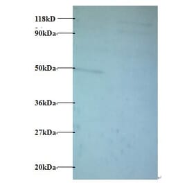Protein AATF Polyclonal Antibody from Signalway Antibody (42429) - Antibodies.com