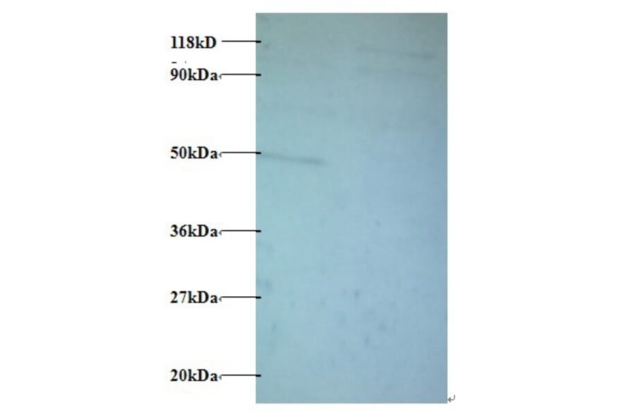 Protein AATF Polyclonal Antibody from Signalway Antibody (42429) - Antibodies.com