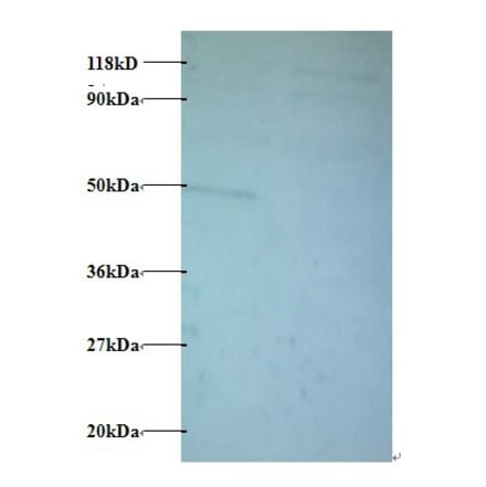Protein AATF Polyclonal Antibody from Signalway Antibody (42429) - Antibodies.com