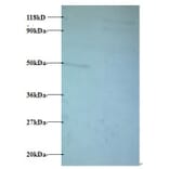 Protein AATF Polyclonal Antibody from Signalway Antibody (42429) - Antibodies.com