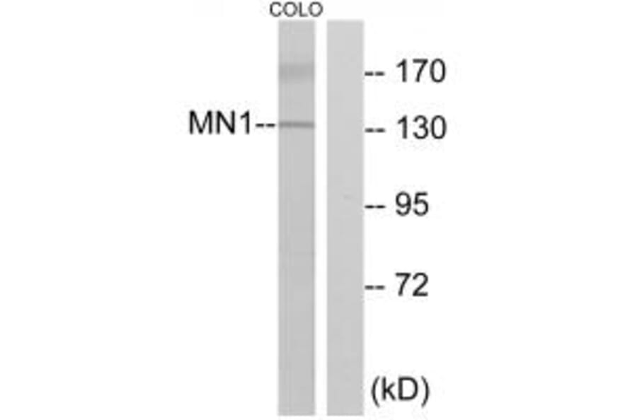 Western blot - MN1Antibody from Signalway Antibody (33865) - Antibodies.com