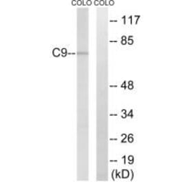 Western blot - C9 Antibody from Signalway Antibody (34612) - Antibodies.com