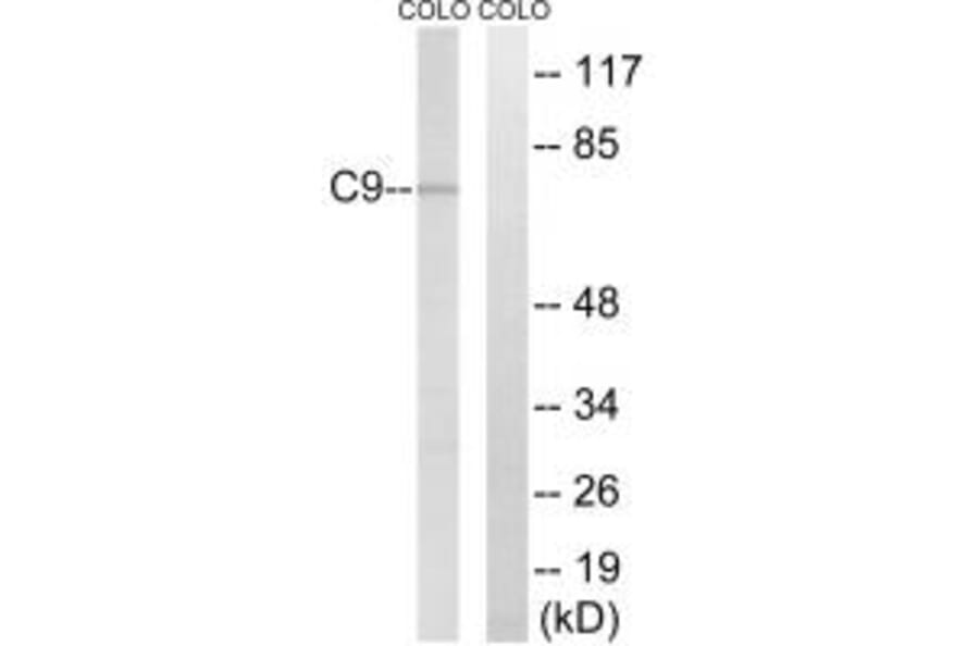 Western blot - C9 Antibody from Signalway Antibody (34612) - Antibodies.com