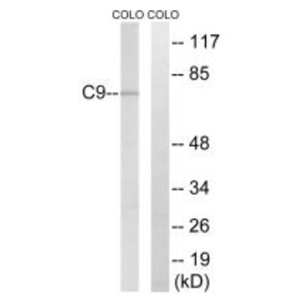 Western blot - C9 Antibody from Signalway Antibody (34612) - Antibodies.com