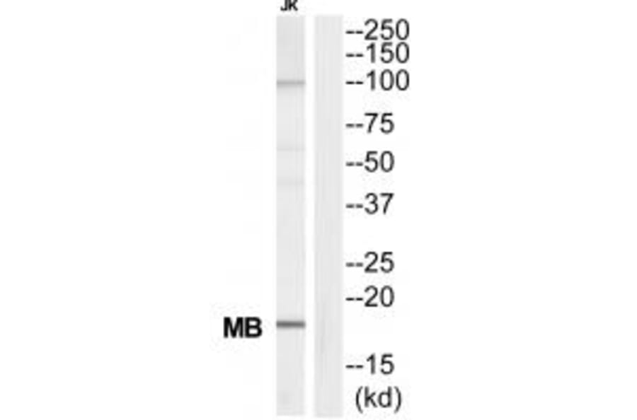 Western blot - MB Antibody from Signalway Antibody (34815) - Antibodies.com
