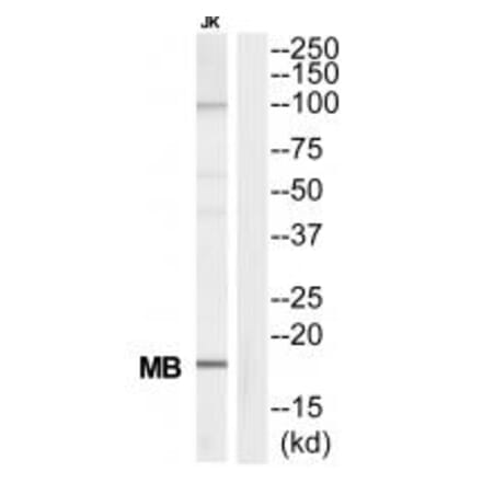 Western blot - MB Antibody from Signalway Antibody (34815) - Antibodies.com