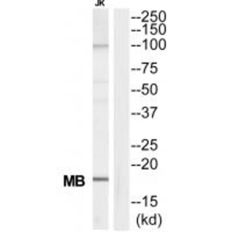 Western blot - MB Antibody from Signalway Antibody (34815) - Antibodies.com