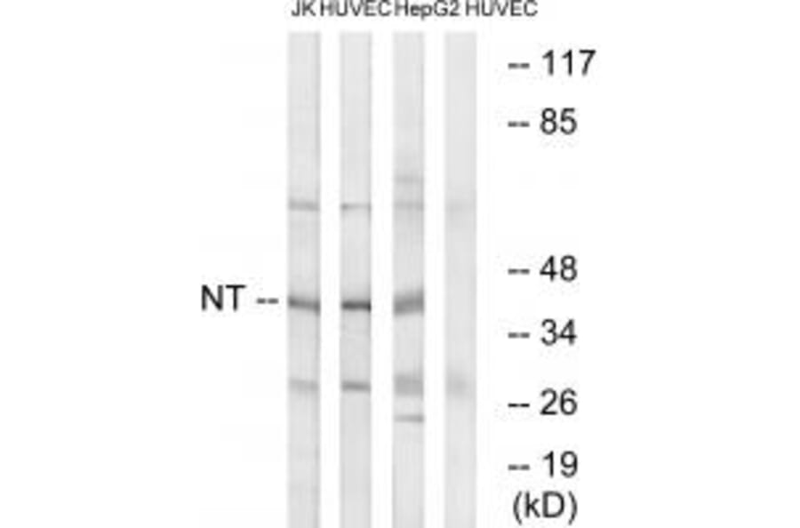 Western blot - NT Antibody from Signalway Antibody (34864) - Antibodies.com