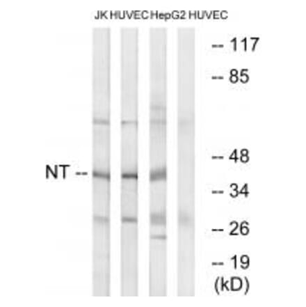 Western blot - NT Antibody from Signalway Antibody (34864) - Antibodies.com