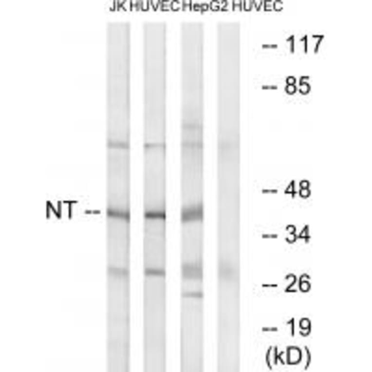 Western blot - NT Antibody from Signalway Antibody (34864) - Antibodies.com