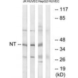 Western blot - NT Antibody from Signalway Antibody (34864) - Antibodies.com