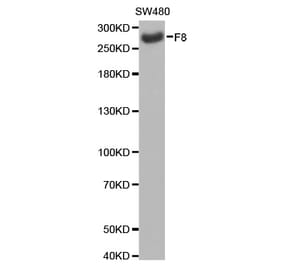 Western blot - F8 antibody from Signalway Antibody (38232) - Antibodies.com