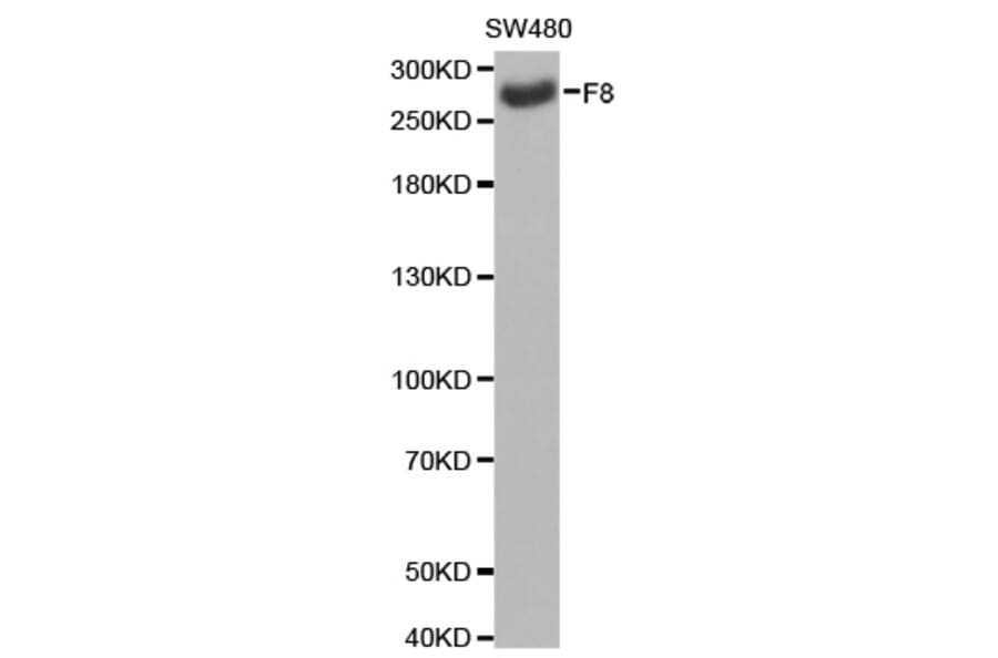 Western blot - F8 antibody from Signalway Antibody (38232) - Antibodies.com