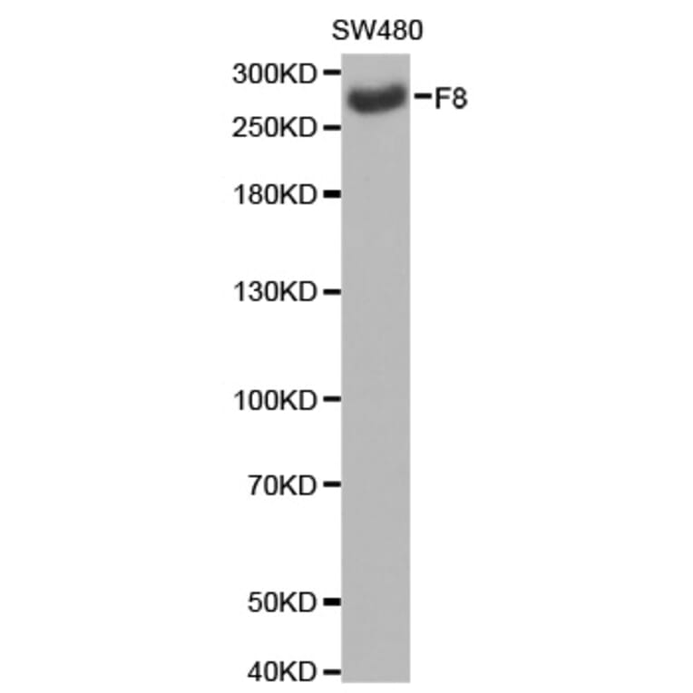 Western blot - F8 antibody from Signalway Antibody (38232) - Antibodies.com