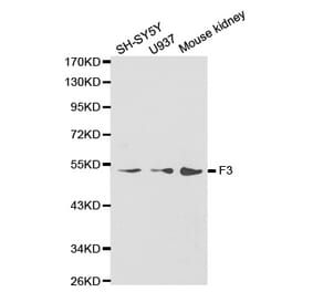 Western blot - F3 antibody from Signalway Antibody (38235) - Antibodies.com