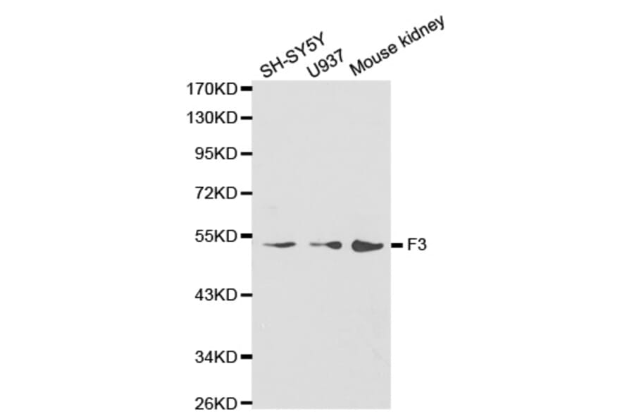 Western blot - F3 antibody from Signalway Antibody (38235) - Antibodies.com