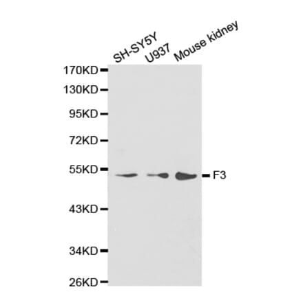 Western blot - F3 antibody from Signalway Antibody (38235) - Antibodies.com