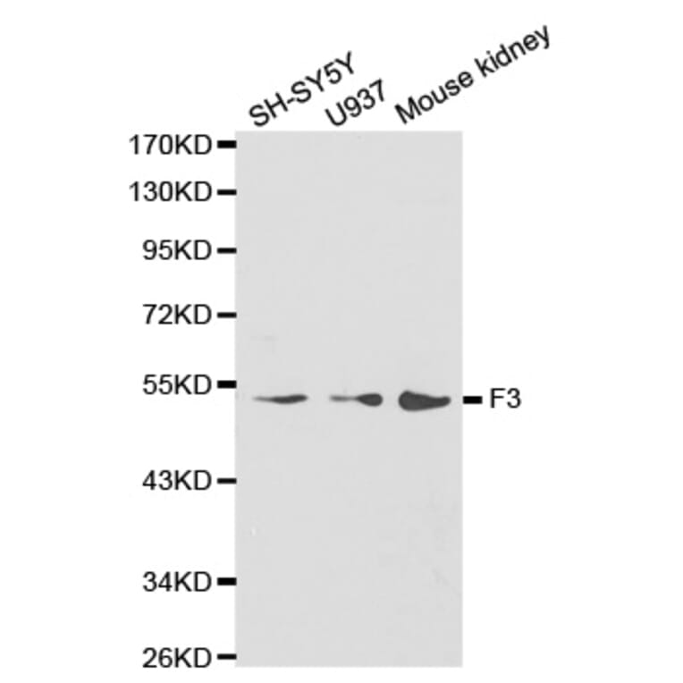 Western blot - F3 antibody from Signalway Antibody (38235) - Antibodies.com