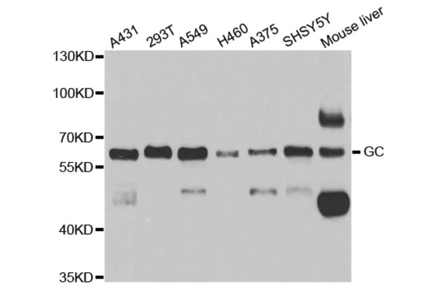 Western blot - GC antibody from Signalway Antibody (38683) - Antibodies.com